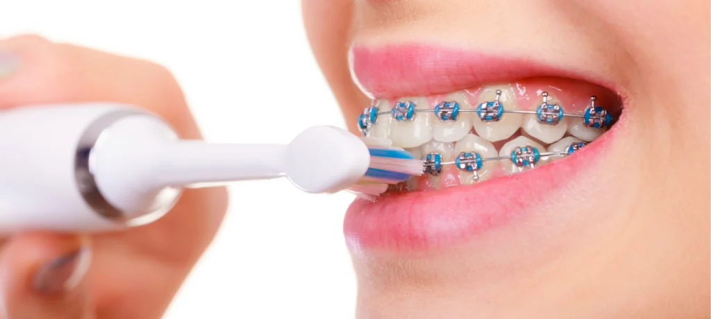 Brossage des dents Dr Déborah Fellous | Orthodontiste à Charenton-le-Pont