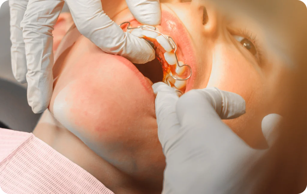 Orthodontie de l’enfant