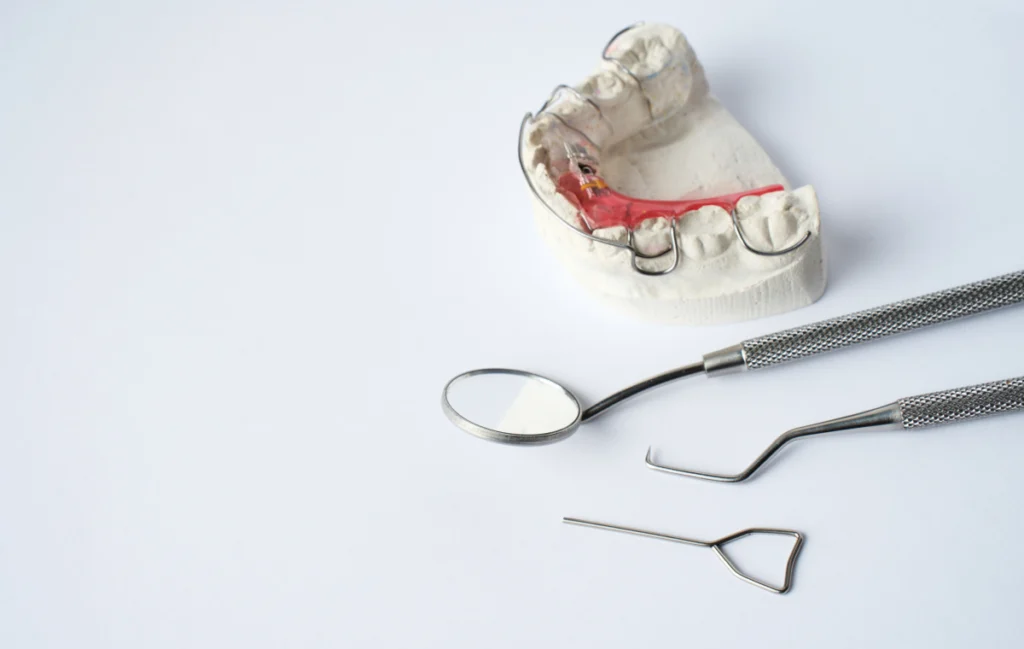 Plaque palatine & Bielle de herbst Dr Déborah Fellous | Orthodontiste à Charenton-le-Pont