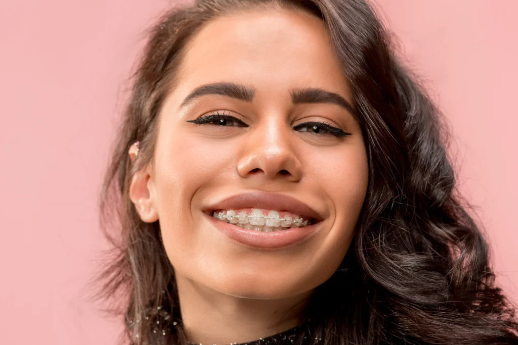 consultation orthodontiste adulte saint maurice Orthodontiste à Saint-Maurice Dr Déborah Fellous, Orthodontiste à Charenton-le-Pont