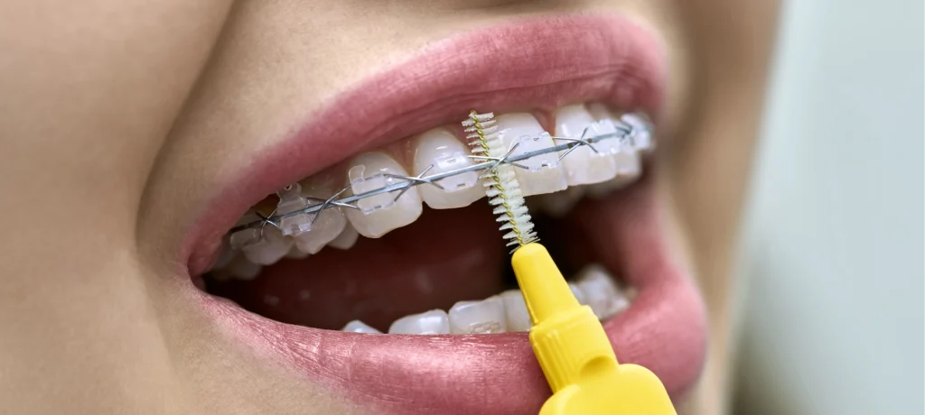 consultation orthodontiste maisons alfort appareils dentaires Orthodontiste à Maisons-Alfort Dr Déborah Fellous, Orthodontiste à Charenton-le-Pont