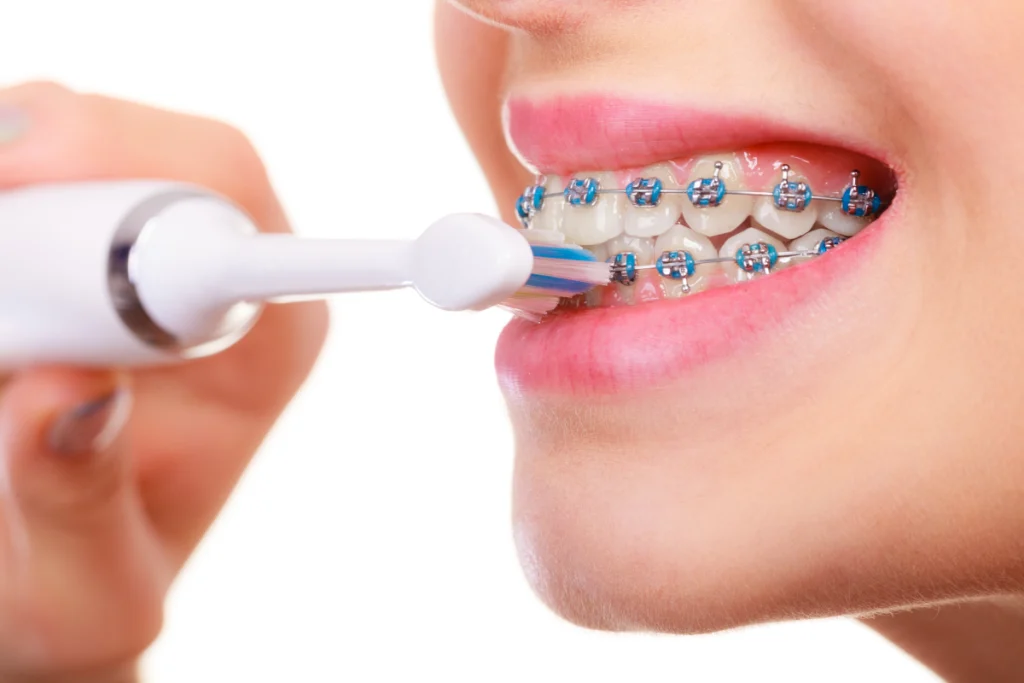 consultation orthodontiste saint maurice hygiene Orthodontiste à Saint-Maurice Dr Déborah Fellous, Orthodontiste à Charenton-le-Pont